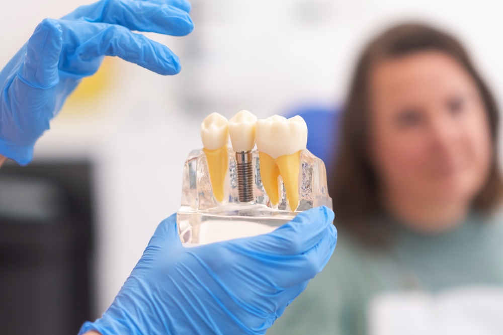 Dental Implants for Denture Wearers: Upgrade Your Smile with A Permanent Solution