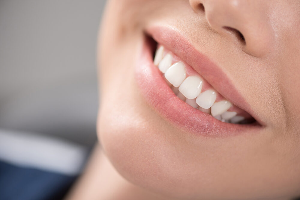A close-up of smooth, bright teeth showcasing the results of professional teeth whitening treatment – Teeth Whitening in Simi Valley